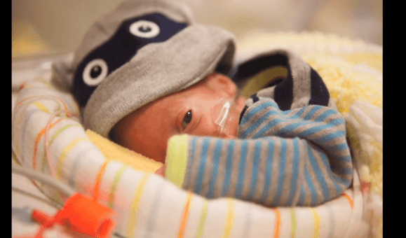 WATCH: 80 Days in ICU. The incredible time-lapse video of a premature baby