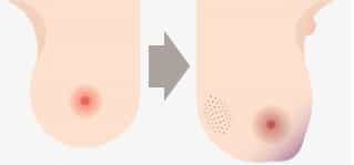 Cancer: These Early Warning Signs Could Save Your Life