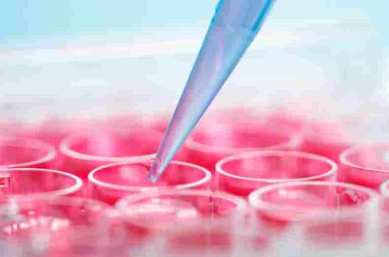 Breakthrough discovery for Alzheimer’s and Multiple Sclerosis at Trinity Collage lab