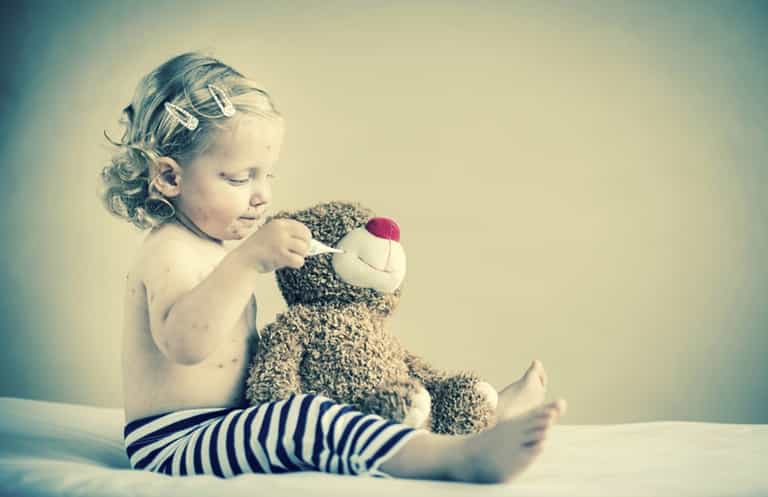 10 times I wanted to run away during chickenpox