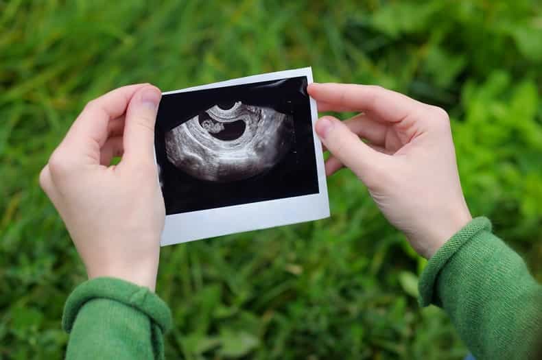 This woman didn’t know she was going to be a mum until she was 8 months pregnant
