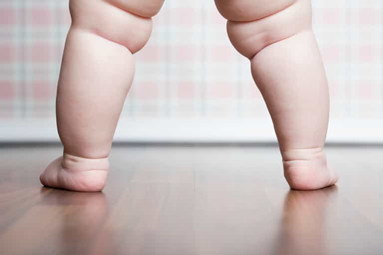 3-year-old girl diagnosed with type-2 diabetes