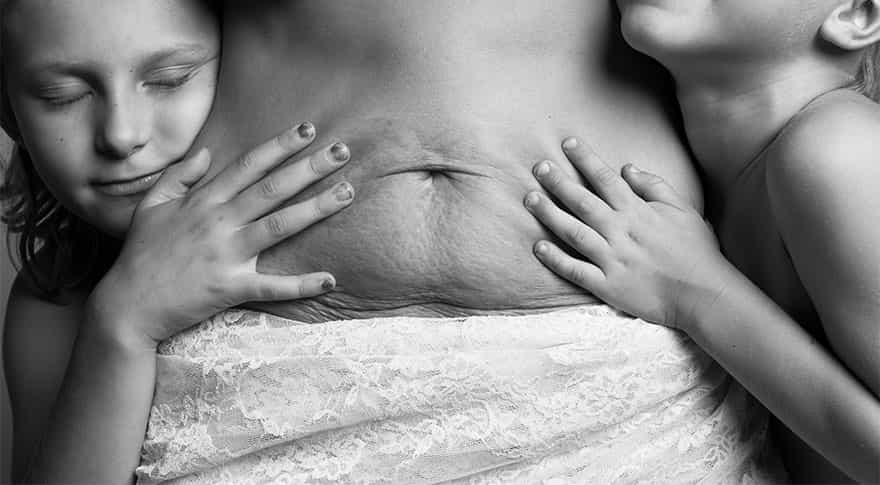 MUST-SEE striking images of beautiful post-baby bodies