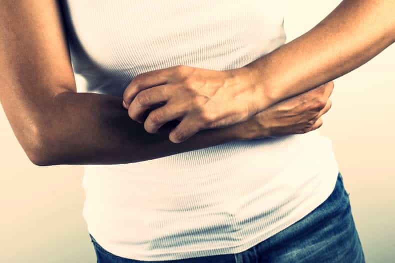 Psoriasis – Is diet part of the problem?
