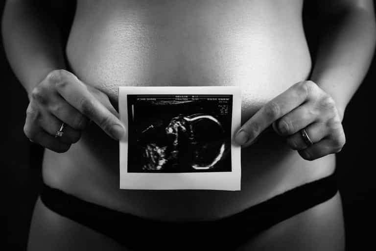 Ever heard of the ‘nub theory’? It claims to reveal your baby’s sex at 12 weeks