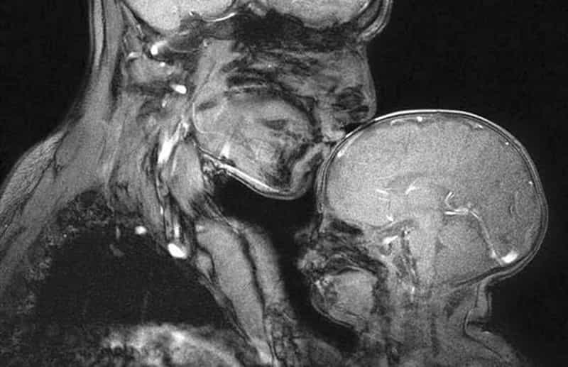This Mama /Baby MRI Scan Shows The Fragility Of Human Life