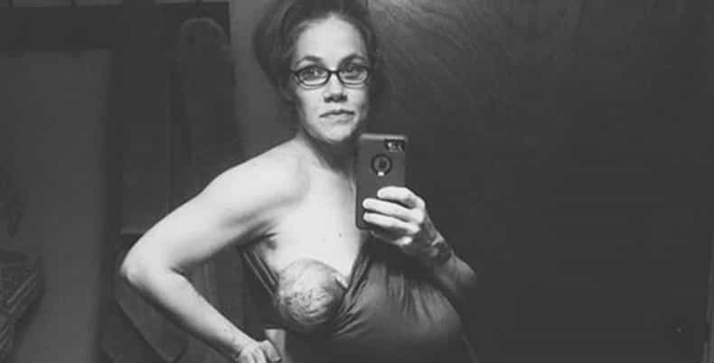 Mother-of-Four Praised for Postpartum Picture