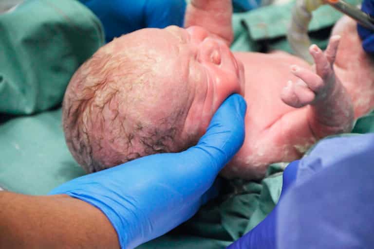 Mother Leaves Placenta Attached To Her Baby For 6 Days