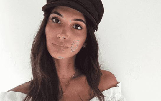 Fashion designer explains her ‘tiny baby bump’ is due to endometriosis