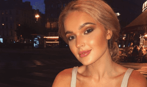 Model shares ‘gruesome’ photos to remind about the dangers of sunbeds