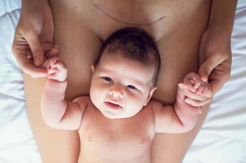 The effects of a C-section last much longer than you think, a new study has found