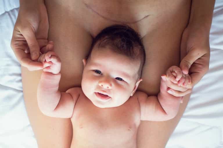 “Stop saying that C-sections are the easy way out!” – a mother’s plea