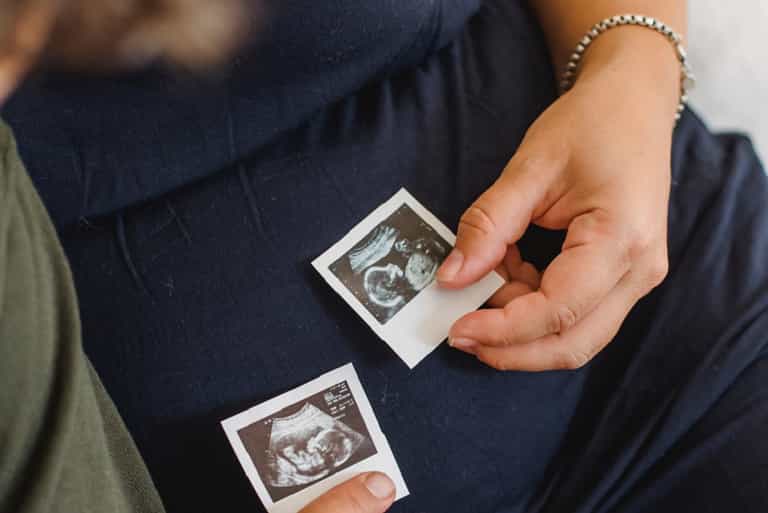 ‘A big surprise’: Mum welcomes four babies in the one year