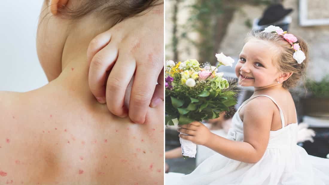 Bride asks to remove niece as flower girl “because of how she looks”