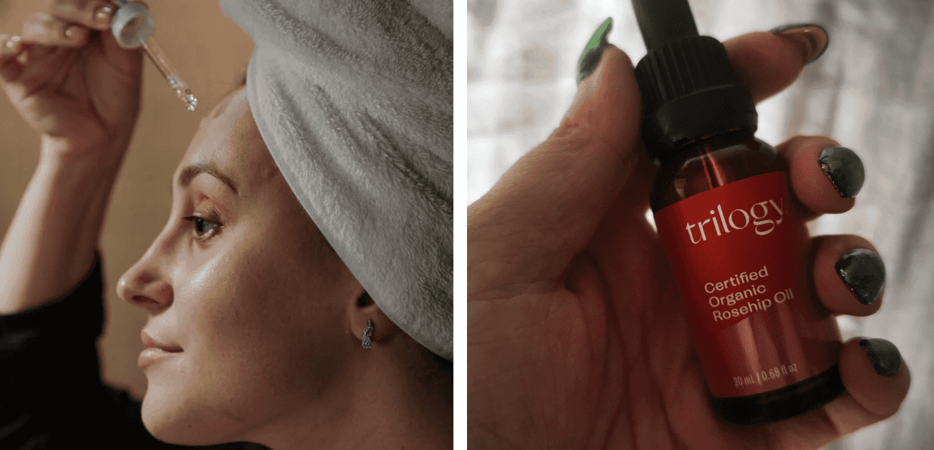 Beauty: the 3 skincare oils that I think everyone over 30 should own