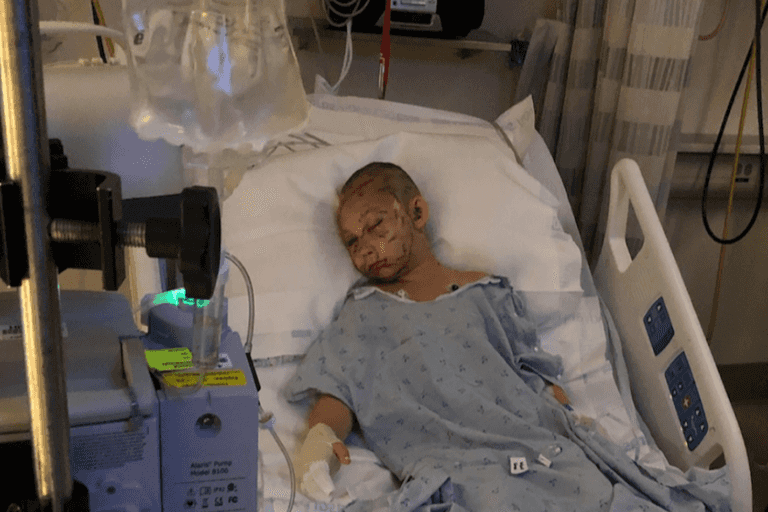 9-year-old girl miraculously survives cougar attack