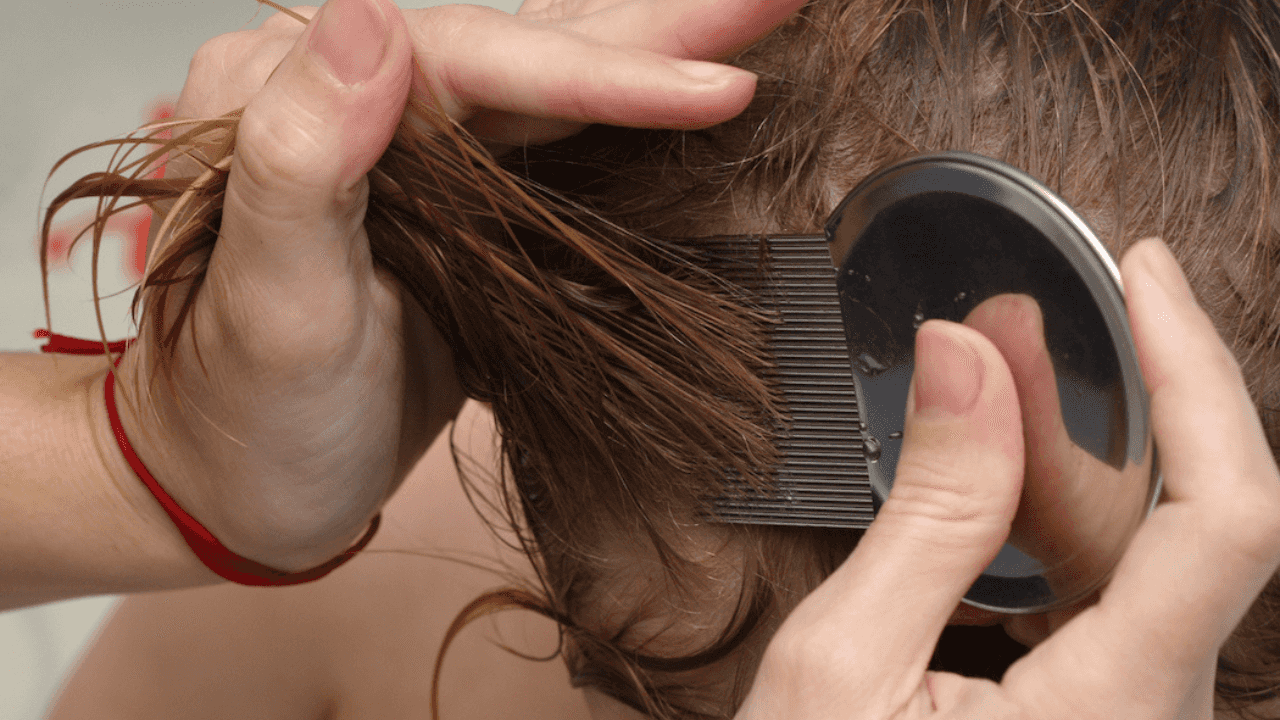 ‘My vegan neighbours won’t remove lice from their child’s hair because it’s cruel’