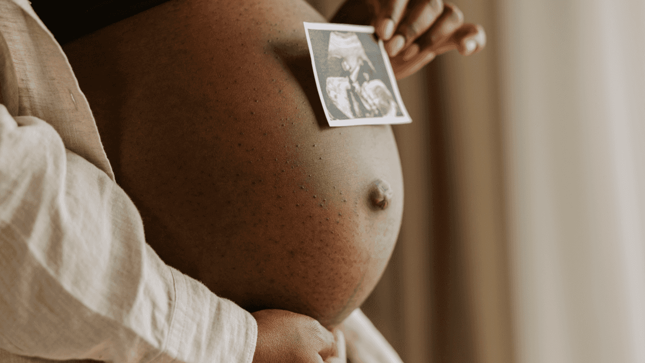 Gestational diabetes cases have doubled in Ireland, experts warn