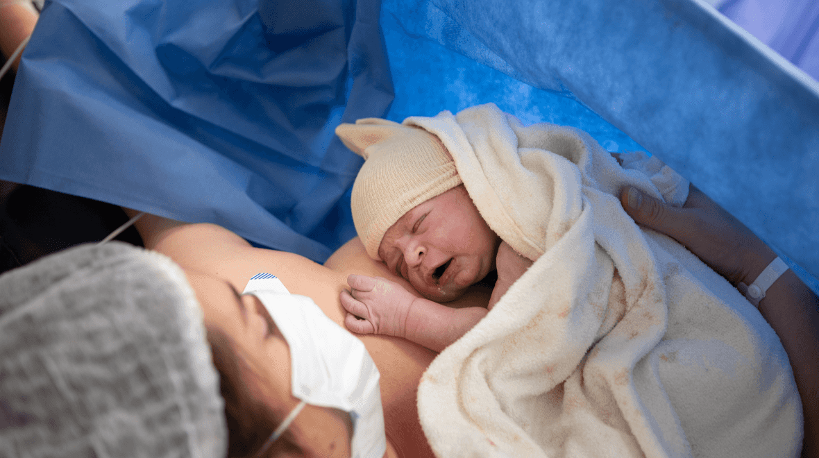 Over 40% of women had caesarean sections in 2024, HSE reports