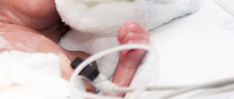 Conjoined Twins ‘Unlikely To Survive’ Conjoined Twins ‘Unlikely To Survive’