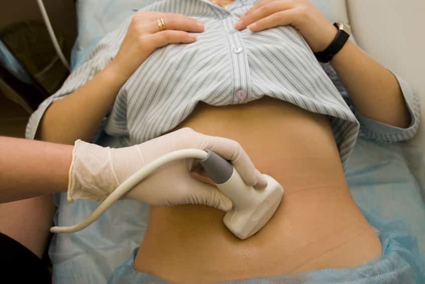 Major breakthrough in link between fibroids and miscarriage