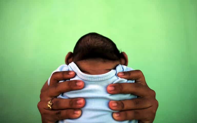 Zika Brain Damage ‘Worse Than Reported’, Says Neurologist
