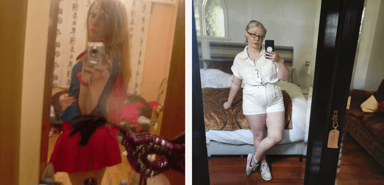 My battle with body dysmorphia stole my teenage years from me My battle with body dysmorphia stole my teenage years from me