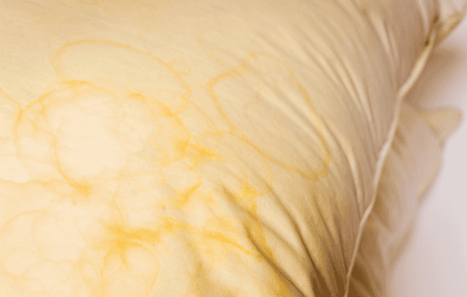 Mrs Hinch fans have genius way of getting yellow stains out of pillows Mrs Hinch fans have genius way of getting yellow stains out of pillows