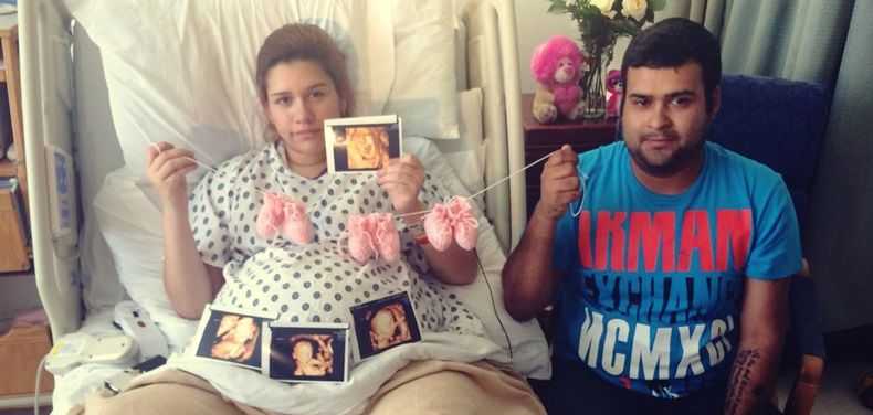 Extremely rare identical triplets, two conjoined, born in Texas