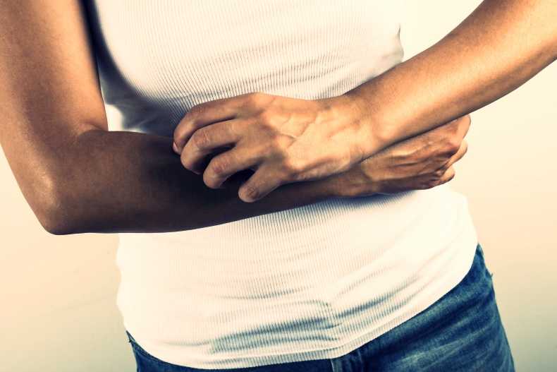 Psoriasis – Is diet part of the problem?