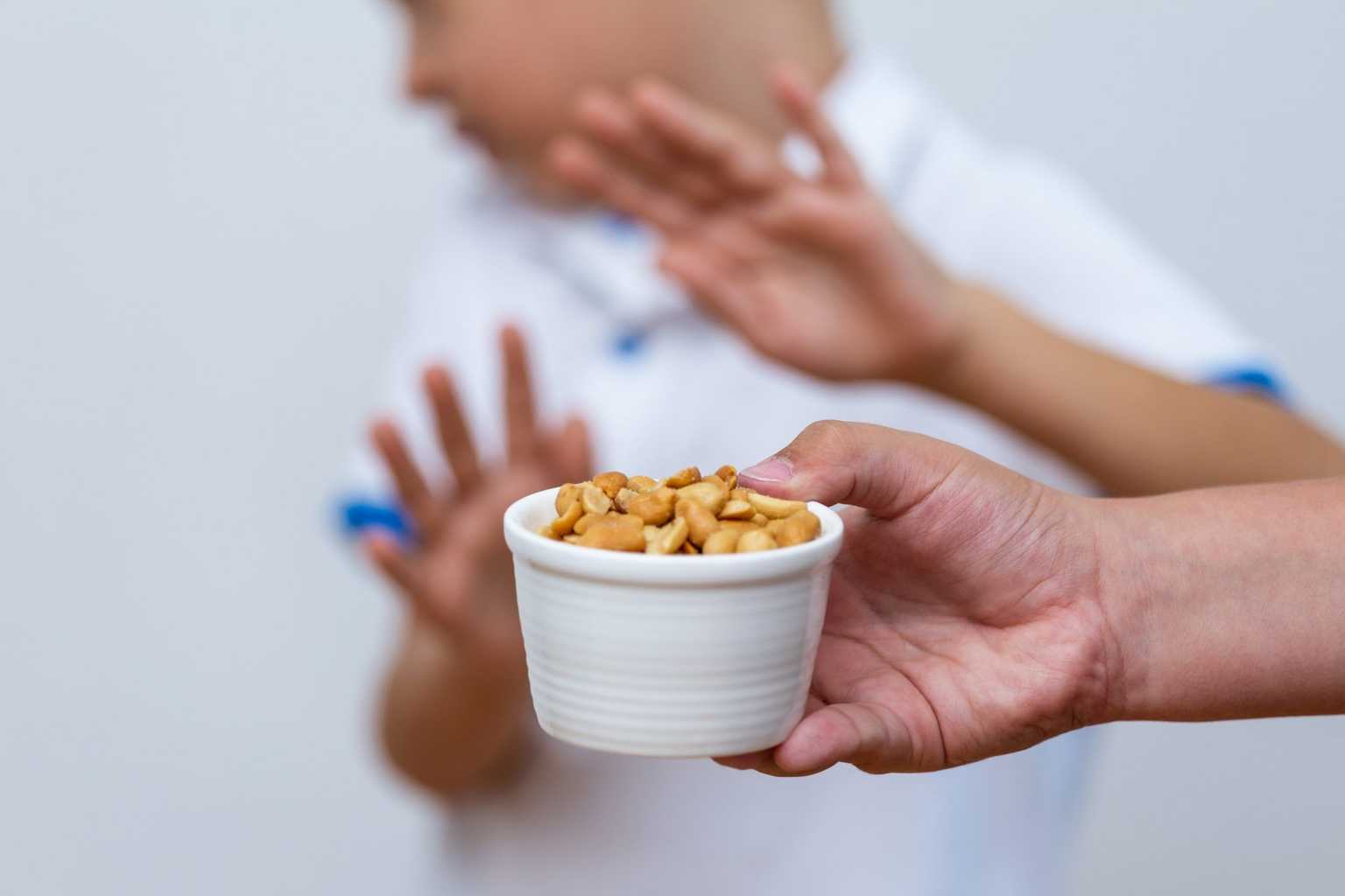 Four early signs of a nut allergy in kids – and what to do