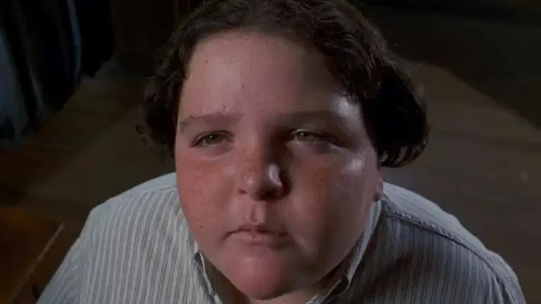 Bruce Bogtrotter star unrecognisable after quitting acting to become a doctor