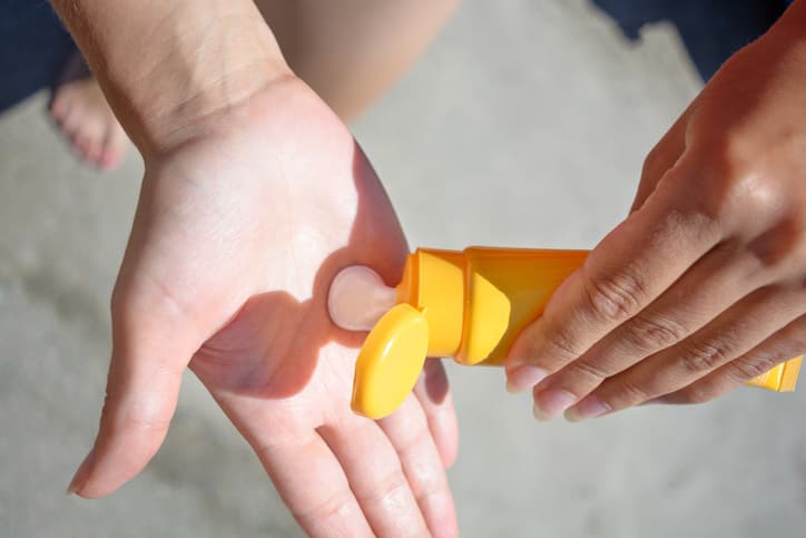 Hospitals are seeing an increase in children admitted for severe sunburn