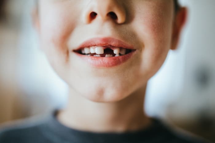 Mum shares photos after toddler accidentally pulls tooth out with tape