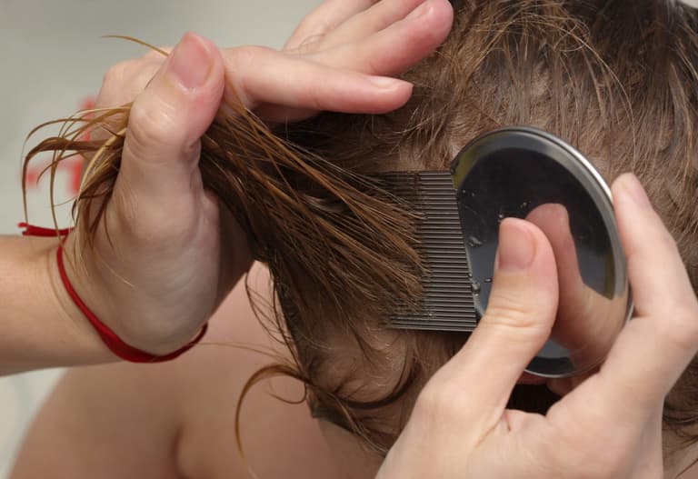 Nit outbreak at home? These products are our go-to treatments you need to use
