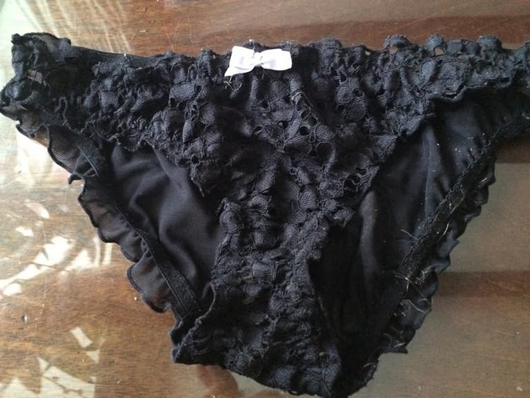 ‘Bleached’ patches in your underwear is normal and young women need to know this