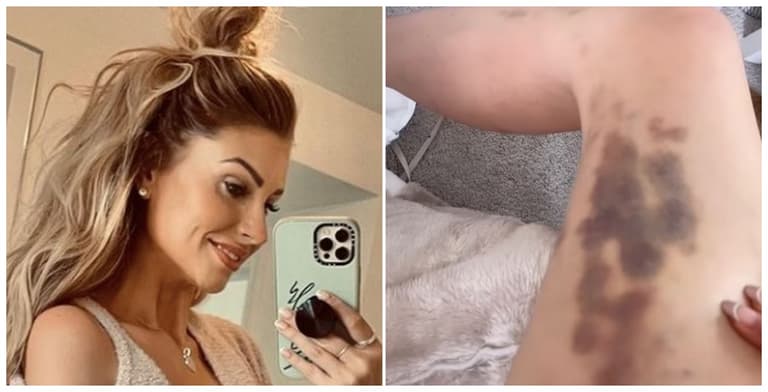Mrs Hinch reveals why she always covers up – even in summer