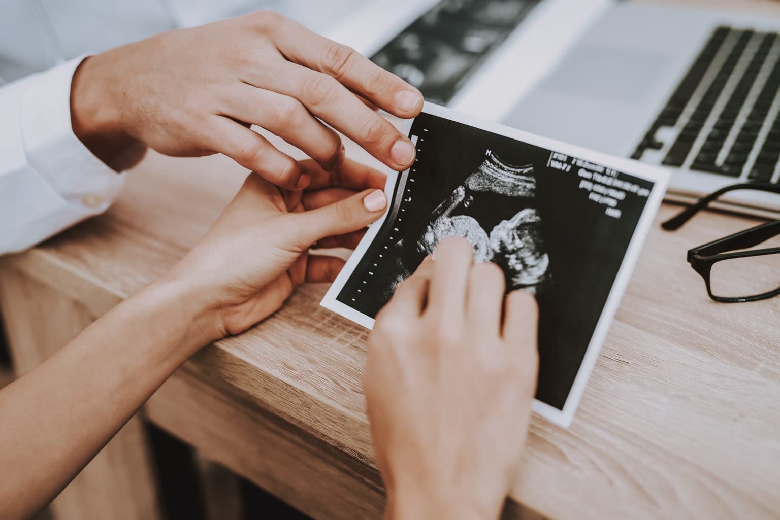 this image shows hands holding an ultrasound scan