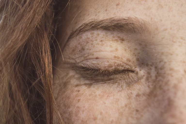 Vhi promises ‘faster and more effective’ dermatology services with latest partnership