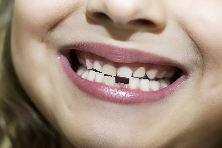 This 9-year-old just asked the tooth fairy to take a selfie to “prove she is real”