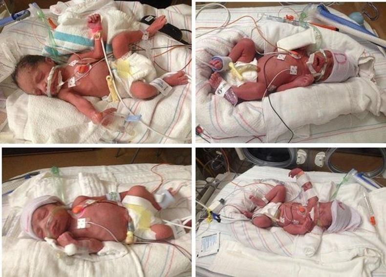 NEWS: Arizona woman dies after giving birth to quadruplets