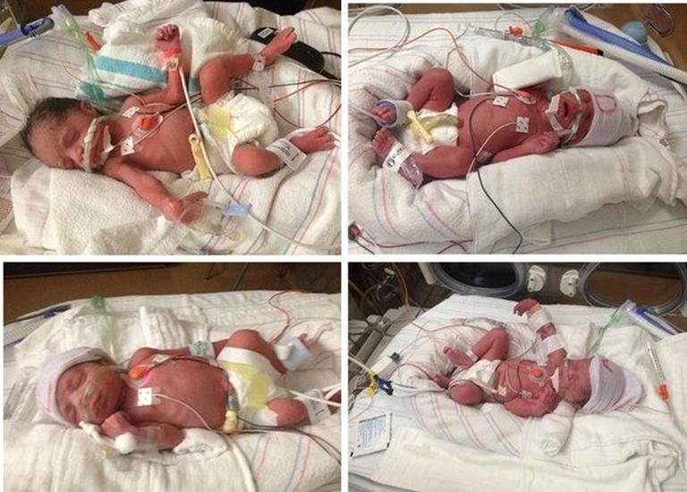 NEWS: Arizona woman dies after giving birth to quadruplets