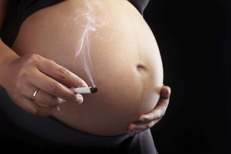 Should pregnant women be paid to quit smoking?