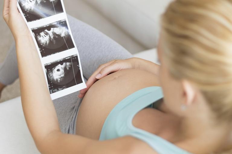 Pregnant women are using two things to figure out the sex of their baby early