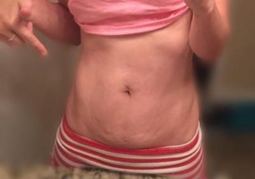 The latest mum tum reveal has got the Internet talking