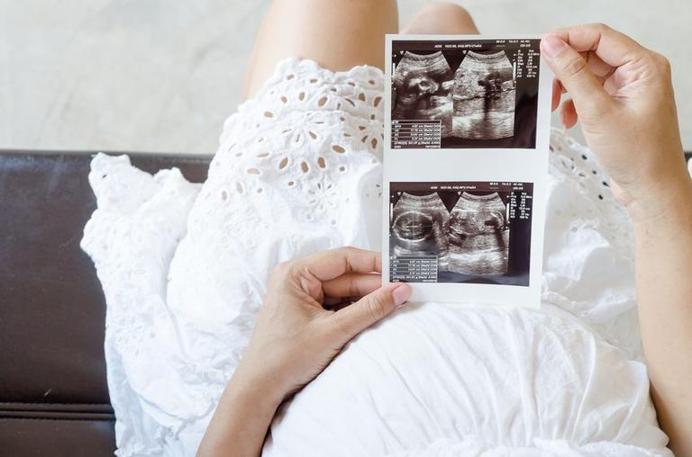 More women are revealing they are pregnant in 1st trimester and why I wish I had too