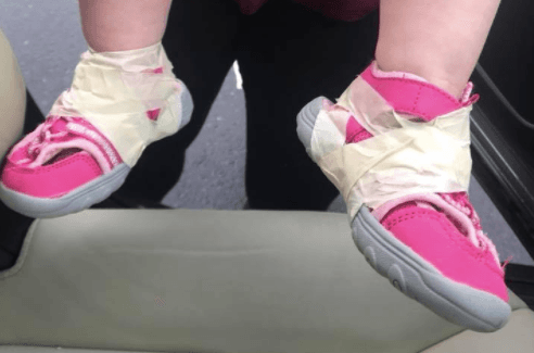 Mum’s fury after nursery ‘taped’ her daughter’s shoes to her feet