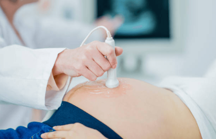 Pregnant woman asks for advice on bringing her mother-in-law along to first scan