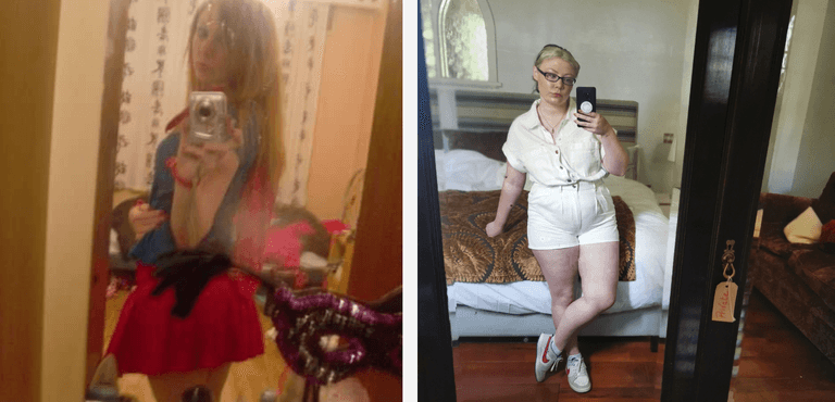 My battle with body dysmorphia stole my teenage years from me