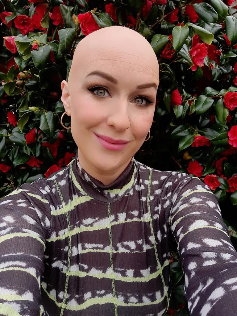 It changed my relationship with beauty: journalist Mary Cate Smith discusses her alopecia journey